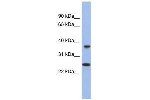 MTRF1L antibody used at 1 ug/ml to detect target protein. (MTRF1L anticorps  (N-Term))