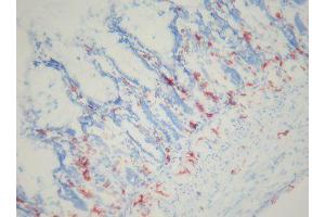 Image no. 3 for anti-Macrophages antibody (ABIN481699) (Macrophages anticorps)