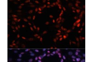 Immunofluorescence analysis of NIH-3T3 cells using MCM5 Polyclonal Antibody at dilution of 1:100.