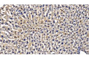 Detection of TOLLIP in Mouse Liver Tissue using Polyclonal Antibody to Toll Interacting Protein (TOLLIP)