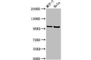 Western Blot Positive WB detected in: MCF-7 whole cell lysate, Hela whole cell lysate All lanes: NUP98 antibody at 3. (NUP98 anticorps  (AA 965-1110))