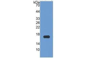 WB of Protein Standard: different control antibodies against Highly purified E.