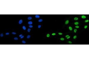 IF analysis of DBC-1/CCAR2 using anti-DBC-1/CCAR2 antibody (ABIN7602235). (CCAR2 anticorps  (AA 65-917))