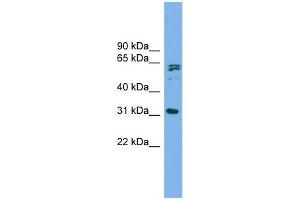 MITD1 antibody used at 1 ug/ml to detect target protein. (MITD1 anticorps  (Middle Region))