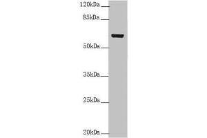 Keratin 6B anticorps  (AA 1-280)
