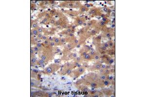 UBE2NL Antibody (N-term) (ABIN656527 and ABIN2845793) immunohistochemistry analysis in formalin fixed and paraffin embedded human liver tissue followed by peroxidase conjugation of the secondary antibody and DAB staining. (UBE2NL anticorps  (N-Term))