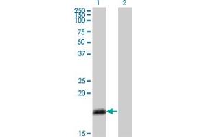 Western Blot analysis of NUMB expression in transfected 293T cell line by NUMB monoclonal antibody (M01), clone 4A7-A6. (NUMB anticorps  (AA 1-135))
