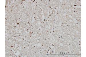 Immunoperoxidase of monoclonal antibody to DNAJB2 on formalin-fixed paraffin-embedded human lateral ventricle wall.