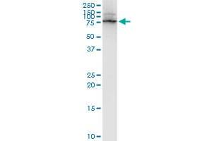 LIMK1 monoclonal antibody (M01), clone 1A8. (LIM Domain Kinase 1 anticorps  (AA 548-647))