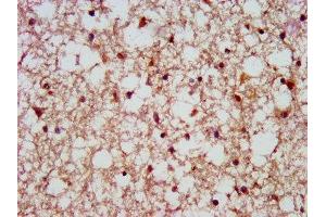 IHC image of ABIN7168719 diluted at 1:500 and staining in paraffin-embedded human brain tissue performed on a Leica BondTM system.