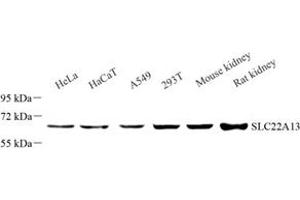 Western blot analysis of SLC22A13 (ABIN7075661) at dilution of 1: 1000 (SLC22A13 anticorps)