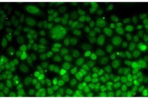 Immunofluorescence analysis of MCF7 cells using UFD1L Polyclonal Antibody (UFD1L anticorps)