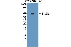 Detection of Recombinant PCSK5, Human using Polyclonal Antibody to Proprotein Convertase Subtilisin/Kexin Type 5 (PCSK5) (PCSK5 anticorps  (AA 115-454))