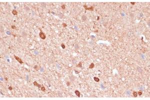 Immunohistochemistry of paraffin-embedded Rat brain using ACAT2 Polyclonal Antibody at dilution of 1:100 (40x lens).
