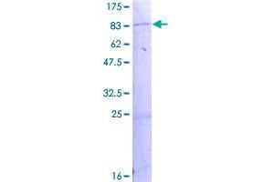 Image no. 1 for Acyloxyacyl Hydrolase (Neutrophil) (AOAH) (AA 1-575) protein (GST tag) (ABIN1345212)
