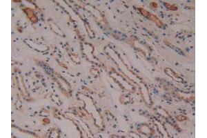 IHC-P analysis of Human Kidney Tissue, with DAB staining. (PTGS2 anticorps  (AA 187-425))
