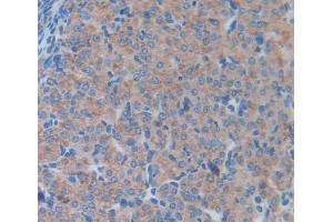 Used in DAB staining on fromalin fixed paraffin- embedded Kidney tissue (LCN5 anticorps  (AA 28-187))