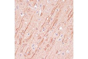Immunohistochemistry of paraffin-embedded rat brain using DLG3 antibody (ABIN7266794) at dilution of 1:100 (40x lens).