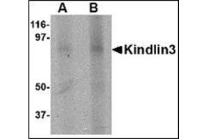 Western blot analysis of KINDLIN3 in rat spleen lysate with this product at (A) 1 and (B) 2 μg/ml. (FERMT3 anticorps  (C-Term))