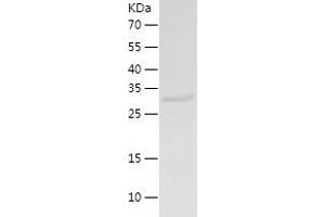 Western Blotting (WB) image for Muscle, Skeletal, Receptor Tyrosine Kinase (MUSK) (AA 756-869) protein (His-IF2DI Tag) (ABIN7124031)