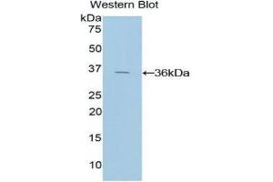 Western Blotting (WB) image for anti-Tissue Factor Pathway Inhibitor (Lipoprotein-Associated Coagulation Inhibitor) (TFPI) (AA 29-306) antibody (ABIN1078583) (TFPI anticorps  (AA 29-306))