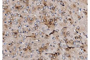 IHC analysis of MPPB/PMPCB using anti-MPPB/PMPCB antibody (ABIN7600758). (PMPCB anticorps  (AA 23-479))