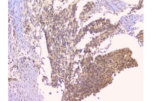 IHC analysis of TNFRSF11B using anti-TNFRSF11B antibody (ABIN7600875).