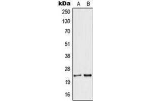 Western blot analysis of Secretogranin 5 expression in HEK293T (A), MCF7 (B) whole cell lysates.