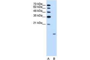 WB Suggested Anti-GCG Antibody Titration:  1. (Glucagon anticorps  (N-Term))
