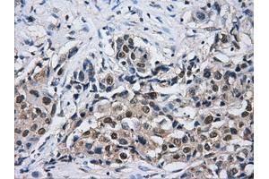 Immunohistochemical staining of paraffin-embedded Kidney tissue using anti-HDAC10mouse monoclonal antibody. (HDAC10 anticorps)