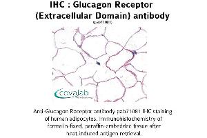 Image no. 1 for anti-Glucagon Receptor (GCGR) (1st Extracellular Domain) antibody (ABIN1734751) (Glucagon Receptor anticorps  (1st Extracellular Domain))