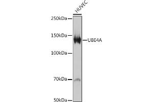 Western blot analysis of extracts of HUVEC cells, using UBE4A antibody (ABIN7271190) at 1:1000 dilution. (UBE4A anticorps)