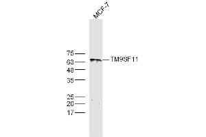 MCF-7 lysates probed with TM9SF1 Polyclonal Antibody, Unconjugated  at 1:300 dilution and 4˚C overnight incubation. (TM9SF1 anticorps  (AA 51-150))