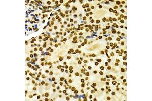 Immunohistochemistry of paraffin-embedded Mouse kidney using DiMethyl-Histone H3-K27 antibody.