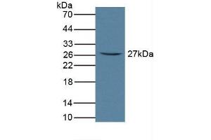 Detection of FcaR in Rat Serum using Polyclonal Antibody to Fc Fragment Of IgA Receptor (FcaR)