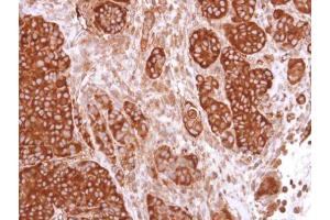 anti-Calcium/calmodulin-Dependent Protein Kinase IV (CAMK4) antibody