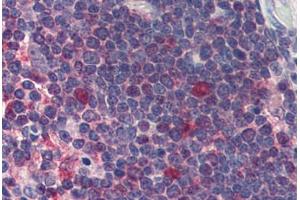 Thymus, Human: Formalin-Fixed, Paraffin-Embedded (FFPE)