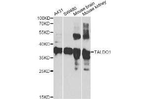 Western blot analysis of extracts of various cell lines, using TALDO1 antibody (ABIN2560291) at 1:1000 dilution. (TALDO1 anticorps)
