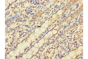 Immunohistochemistry of paraffin-embedded human colon tissue using ABIN7162692 at dilution of 1:100