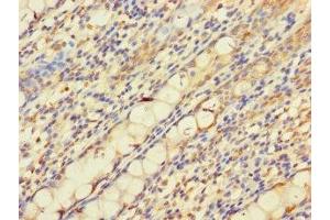 Immunohistochemistry of paraffin-embedded human colon tissue using ABIN7162692 at dilution of 1:100 (PNPLA2 anticorps  (AA 1-504))