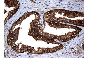 Image no. 6 for anti-Non-Metastatic Cells 1, Protein (NM23A) Expressed in (NME1) antibody (ABIN1499754)