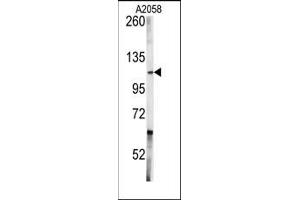 Image no. 1 for anti-C-Abl Oncogene 1, Non-Receptor tyrosine Kinase (ABL1) (Middle Region) antibody (ABIN359968) (ABL1 anticorps  (Middle Region))