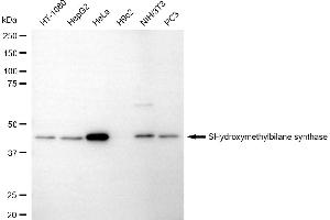 Western blotting analysis using hydroxymethylbilane synthase antibody (ABIN7799012).