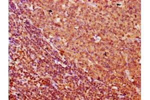 IHC image of ABIN7153151 diluted at 1:500 and staining in paraffin-embedded human tonsil tissue performed on a Leica BondTM system. (FREM1 anticorps  (AA 1957-2082))