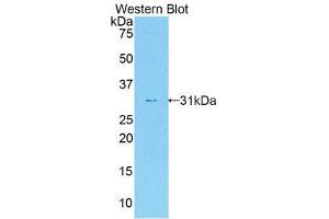 Western Blotting (WB) image for anti-Interleukin 17 Receptor A (IL17RA) (AA 590-848) antibody (ABIN1859358) (IL17RA anticorps  (AA 590-848))