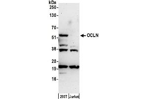 Western Blotting (WB) image for anti-Occludin (OCLN) (AA 472-522) antibody (ABIN7449778)