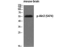 Western Blot (WB) analysis of specific cells using Phospho-Akt2 (S474) Polyclonal Antibody. (AKT2 anticorps  (pSer474))