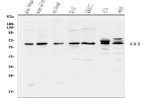 Western blot analysis of YY1 using anti-YY1 antibody (ABIN3044562).
