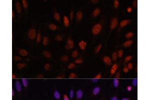 Immunofluorescence analysis of U-2 OS cells using HOXB1 Polyclonal Antibody at dilution of 1:100.
