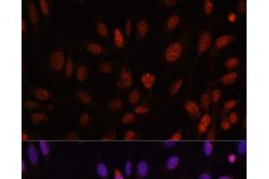 Immunofluorescence analysis of U-2 OS cells using HOXB1 Polyclonal Antibody at dilution of 1:100. (HOXB1 anticorps)
